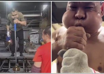 ‘ব্যাঙের রাজপুত্র’ : একটানা ৩০ বছর ধরে কাচের কারখানায় কাজ করার প্রভাব, ব্যাঙের মতো মুখ হয়ে গেছে এক ব্যক্তির 