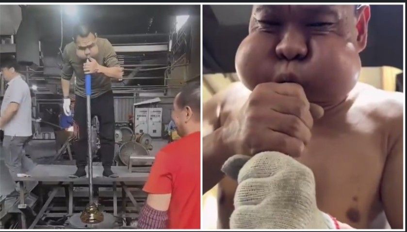 ‘ব্যাঙের রাজপুত্র’ : একটানা ৩০ বছর ধরে কাচের কারখানায় কাজ করার প্রভাব, ব্যাঙের মতো মুখ হয়ে গেছে এক ব্যক্তির 