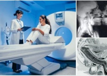 এমআরআই মেশিনের ভেতরে যৌনমিলন, চিরতরে বদলে দিয়েছিল চিকিৎসা বিজ্ঞানকে 