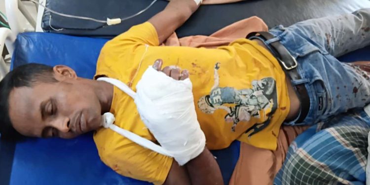 বচসার মাঝে জামাইকে বঁটি দিয়ে কোপানোর অভিযোগ শ্বশুরের বিরুদ্ধে 