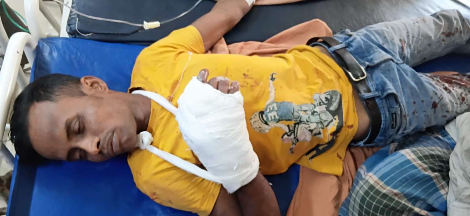 বচসার মাঝে জামাইকে বঁটি দিয়ে কোপানোর অভিযোগ শ্বশুরের বিরুদ্ধে 