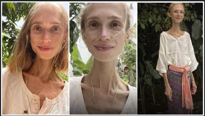 শুধুমাত্র কাঁচা ফল খেয়ে বেঁচে থাকার প্রতিজ্ঞা করা পোলিশ নৃত্যশিল্পীর মর্মান্তিক পরিনতি ; মৃত্যুর আগে ২৭ বছরের ওই তরুনীর ওজন ছিল মাত্র ২২ কেজি