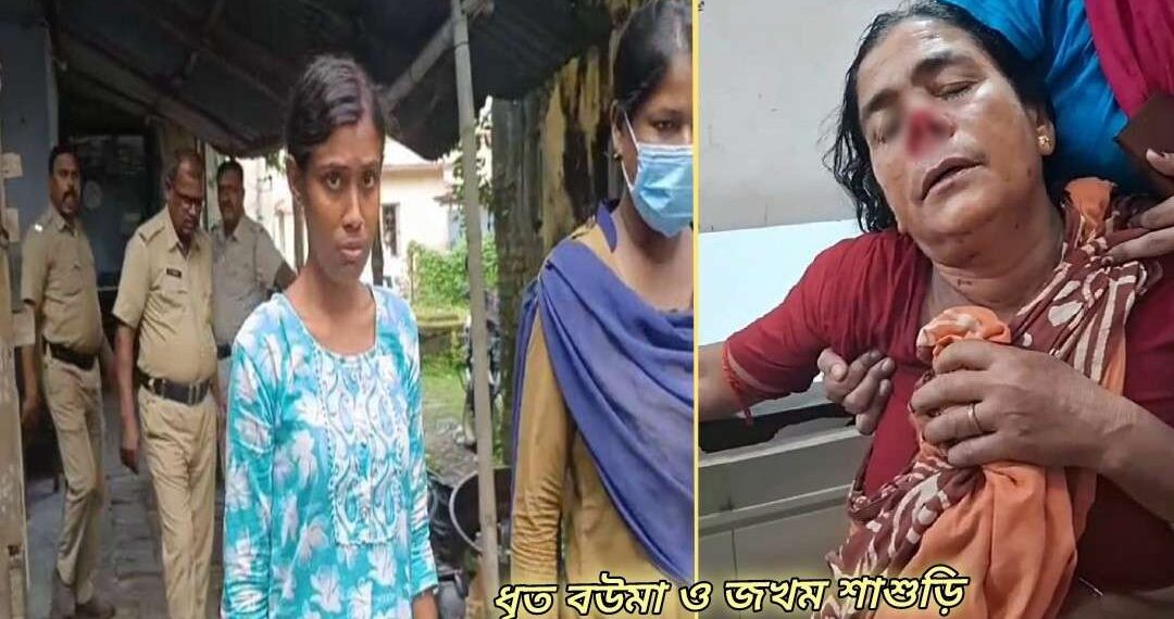 পারিবারিক বিবাদের জেরে কামড়ে শাশুড়ির নাক কেটে নিল বউমা 